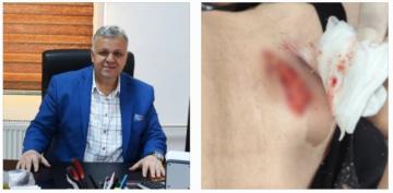 Bilgin Avcı’dan Sert Tepki: “Bu Olayın Araştırılmasını İstiyoruz”